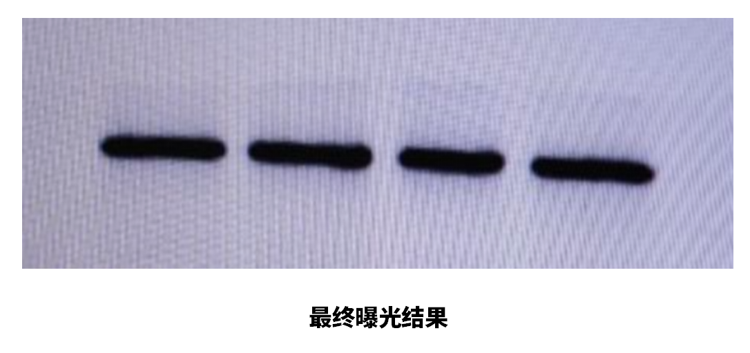 告别手动制胶/转膜烦恼！G1600+T1000双剑合璧，实验效率翻倍不是梦！
